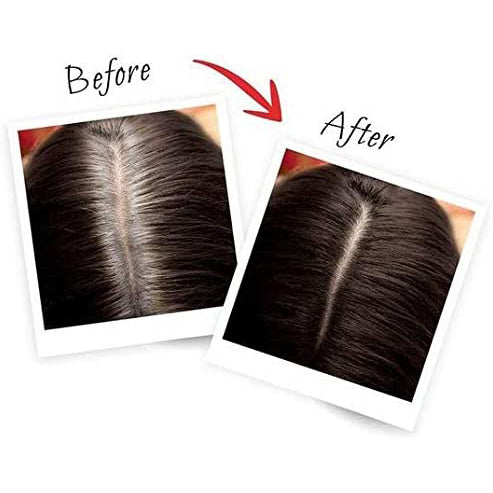 LOREAL MAGIC RETOUCH DARK BROWN 75ML