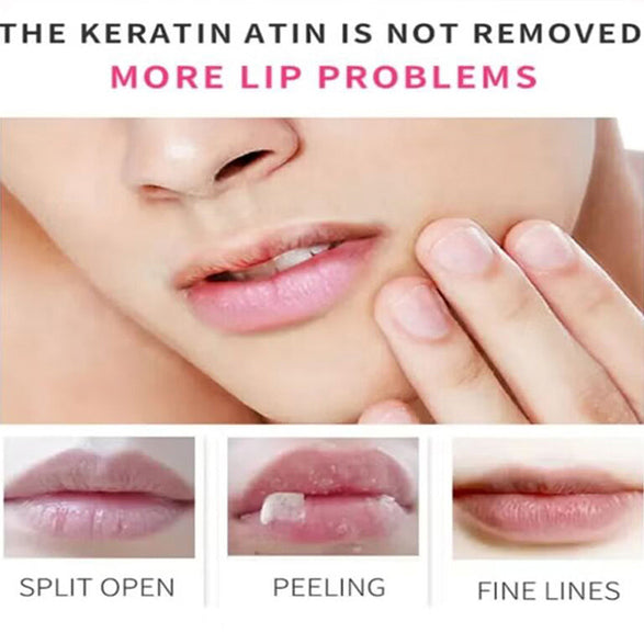 ESTELIN 3IN1 LIP BALM PEACH 5G