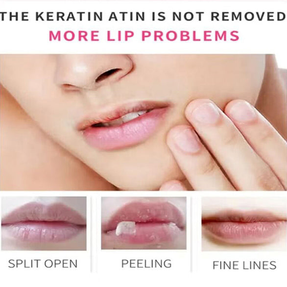 ESTELIN 3IN1 LIP BALM 5G