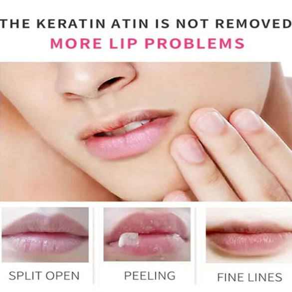 ESTELIN 3IN1 CHEERY LIP BALM 5G