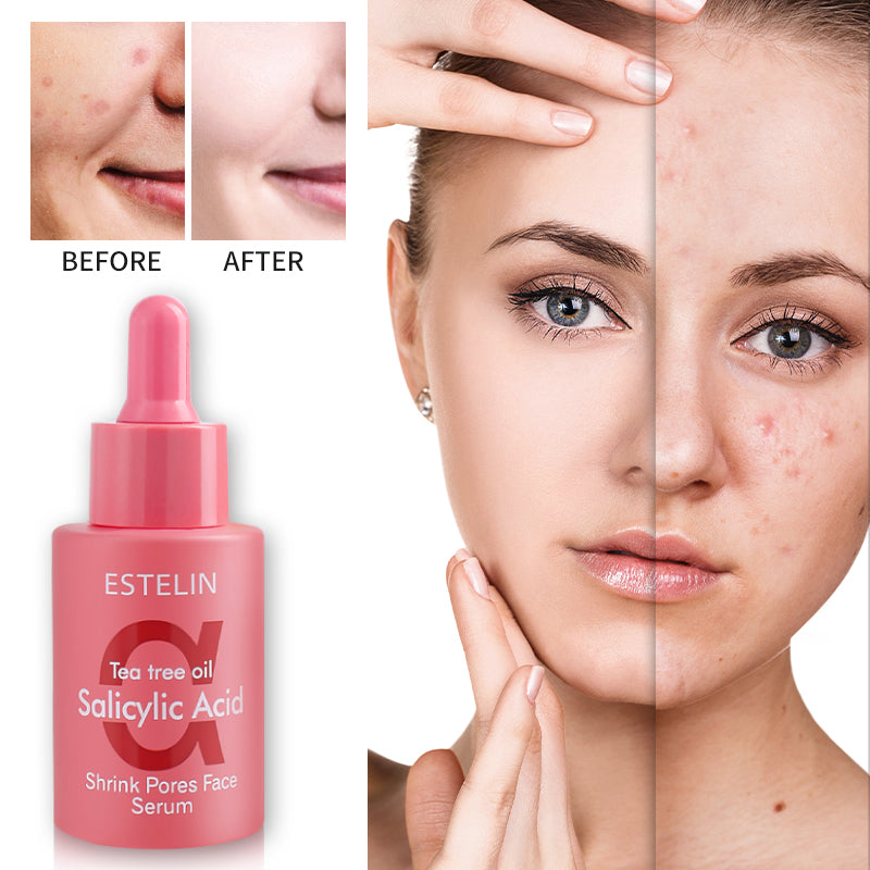 ESTELIN TEA TREE OIL FACE SERUM 30ML