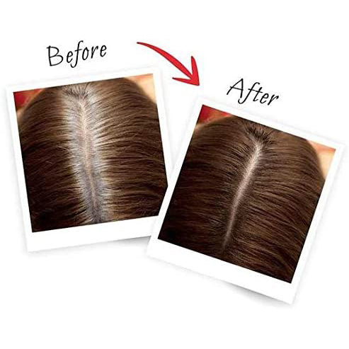 loreal-magic-retouch-brown-75mlL'Oreal Paris Magic Retouch Instant Root Concealer, Brown 75 ml