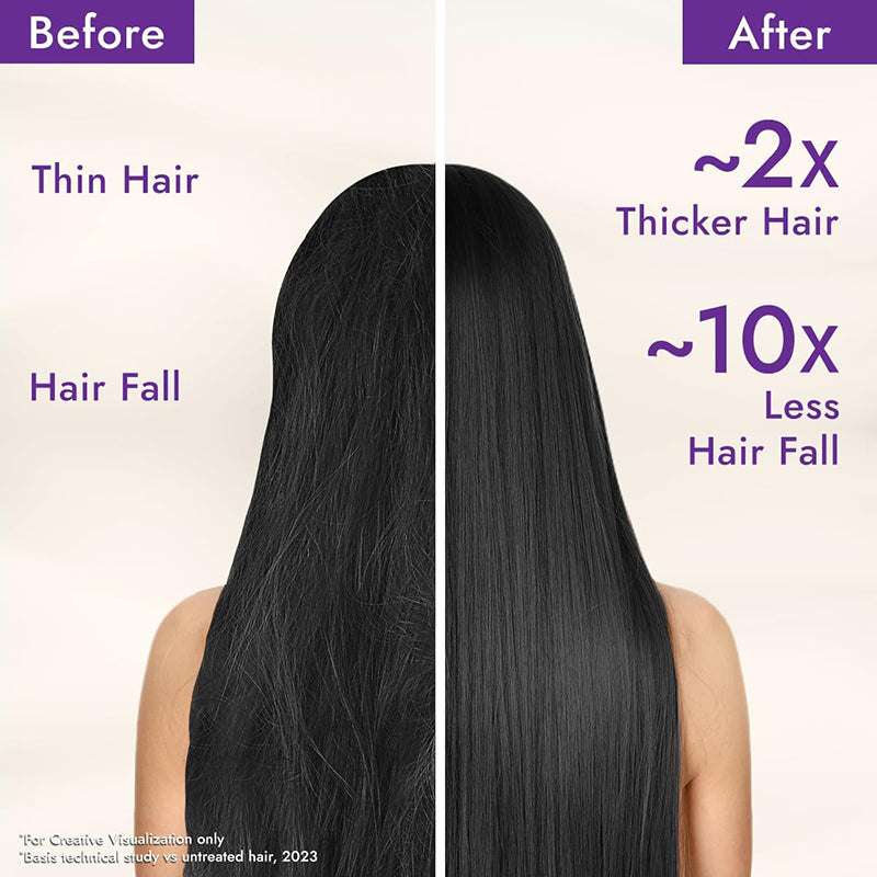 Parachute Advansed Rosemary-enriched Coconut Hair Oil| Rosemary Hair Oil| Superfoods’ Magic| Long & Thick Hair|200 Ml